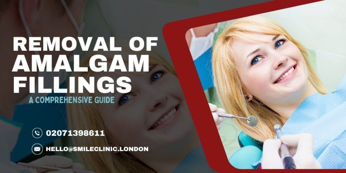 remove amalgam fillings near me