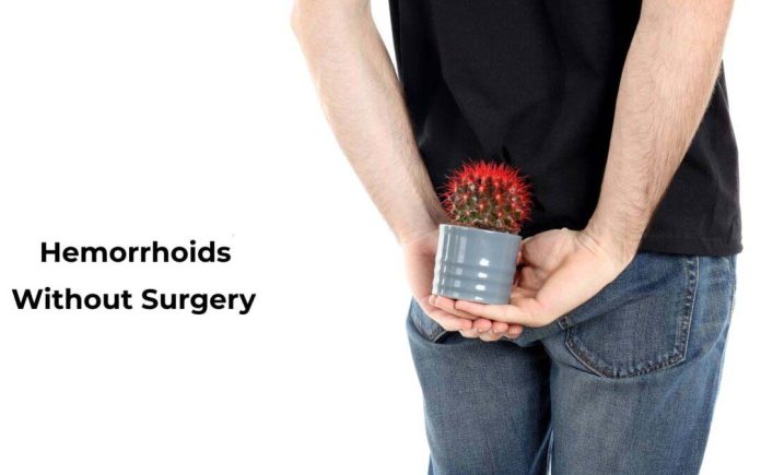 Hemorrhoids