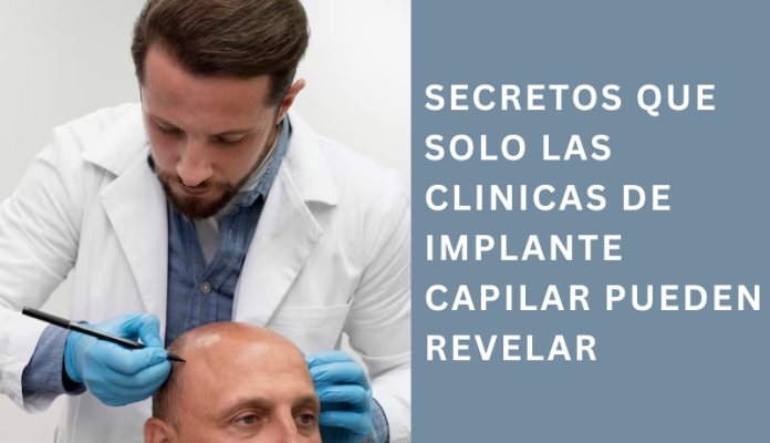 clinicas de implante capilar